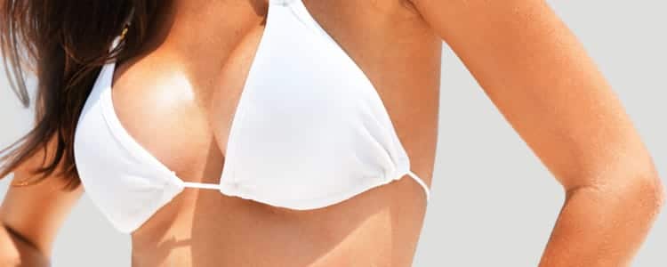 Breastlift