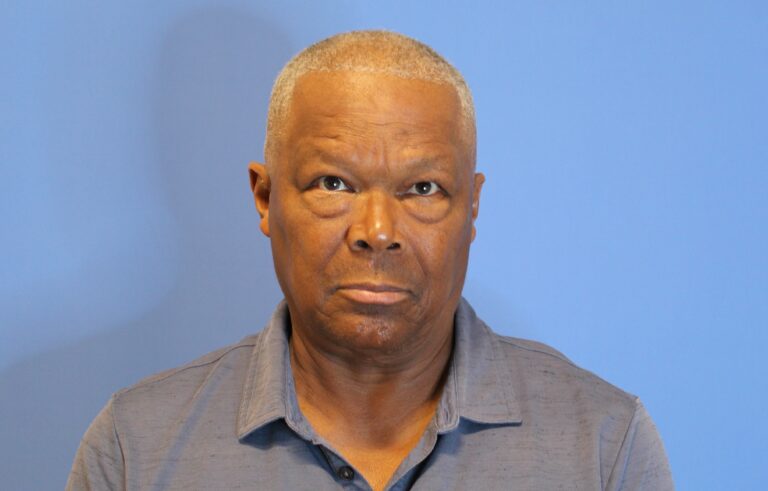 Before Image: Blepharoplasty - front