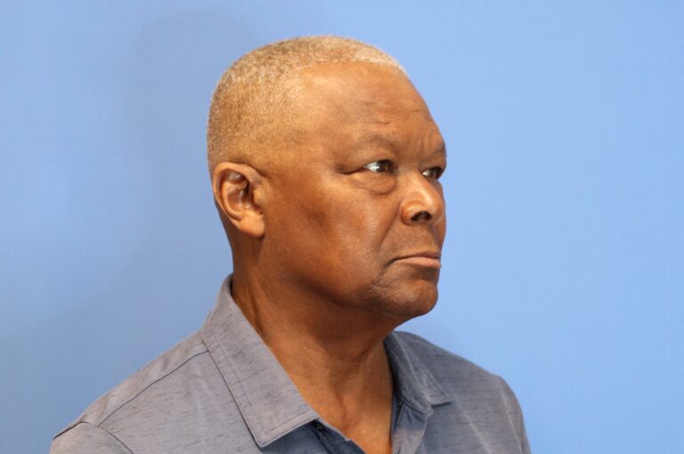 Before Image: Blepharoplasty -