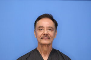 After Image: Blepharoplasty