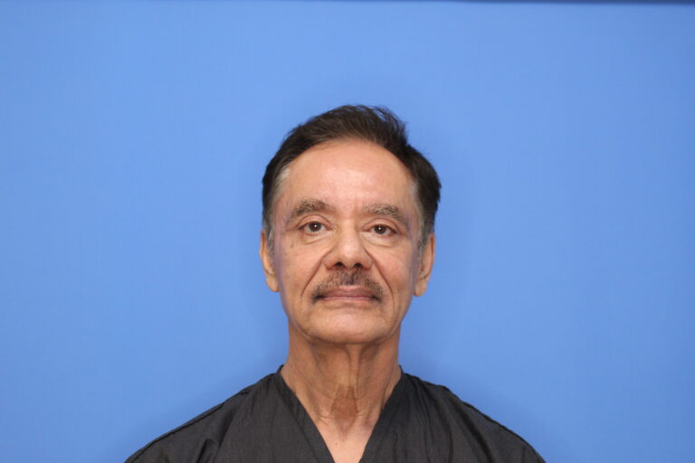 After Image: Blepharoplasty - front