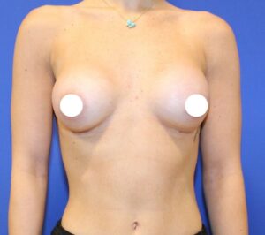 After Image: Preserve