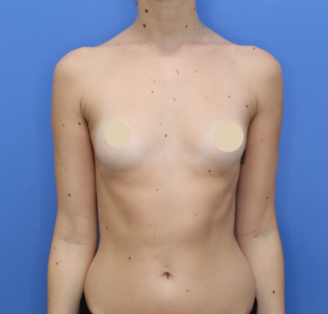 Before Image: Preserve Motiva - front