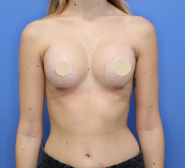 After Image: Preserve Motiva - front