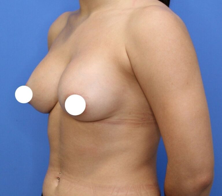 After Image: Preserve - left-front-oblique