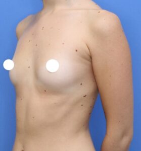 Before Image: Preserve