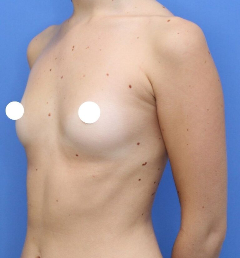 Before Image: Preserve - left-front-oblique