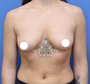 Before Image: Preserve