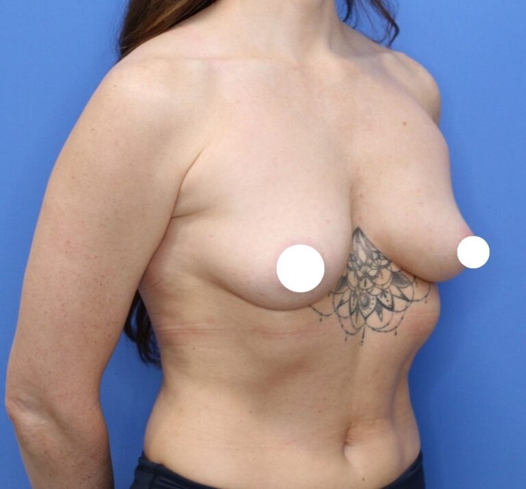 Before Image: Preserve - right-front-oblique