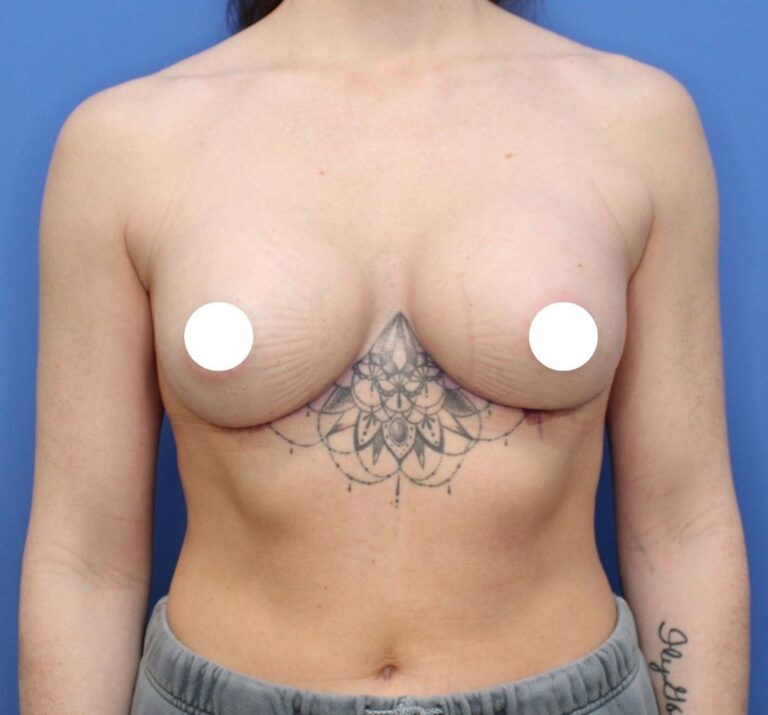 After Image: Preserve - front